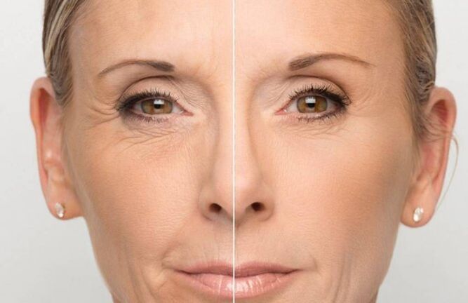 Piel del rostro antes y después del rejuvenecimiento con mascarillas.